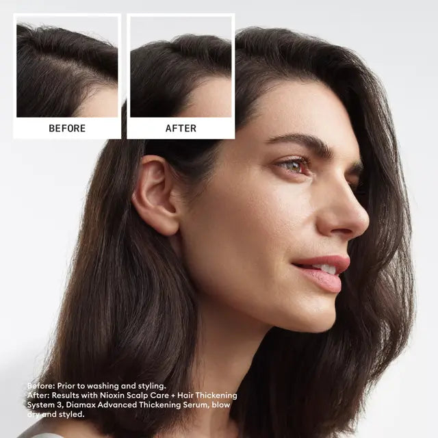 Nioxin Hair System Kit 3 - Image 2