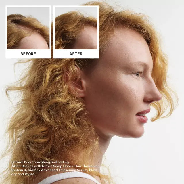 Nioxin Hair System Kit 4 - Image 2